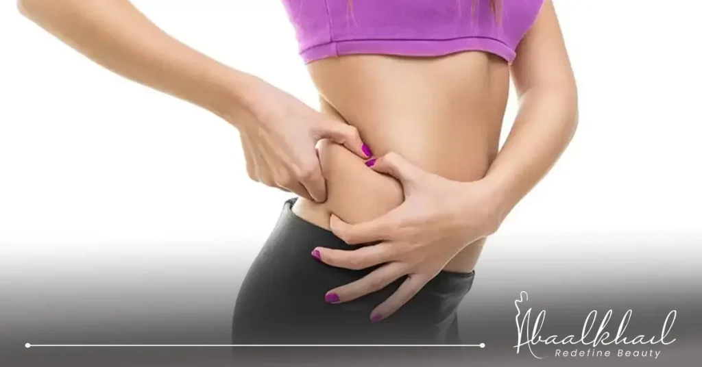 شد الجسم المترهل.