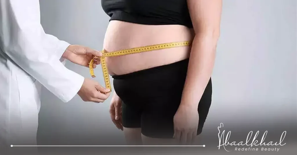 شفط الدهون بالفيزر.