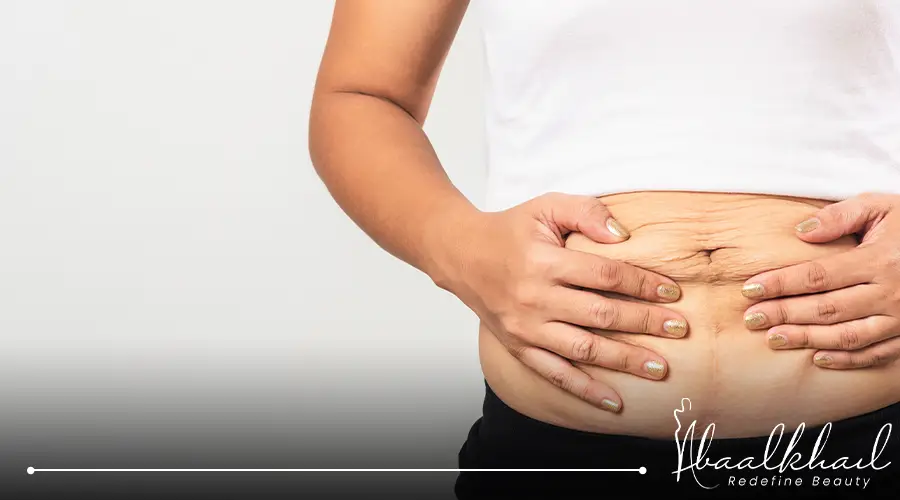 اضرار شفط دهون البطن