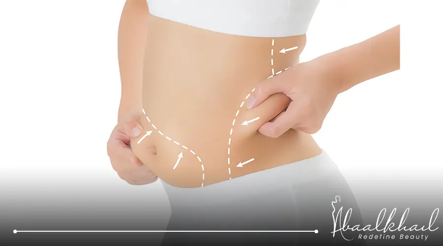 تجربتي مع شفط الدهون بنج موضعي