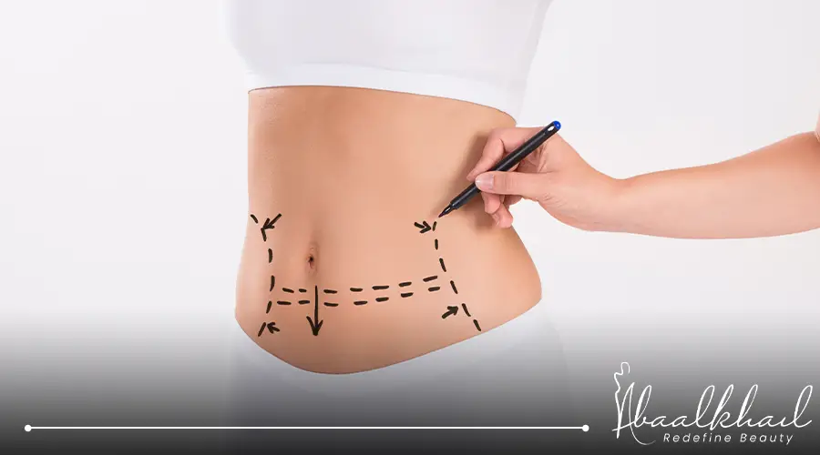 تجربتي مع شفط الدهون وحقنها