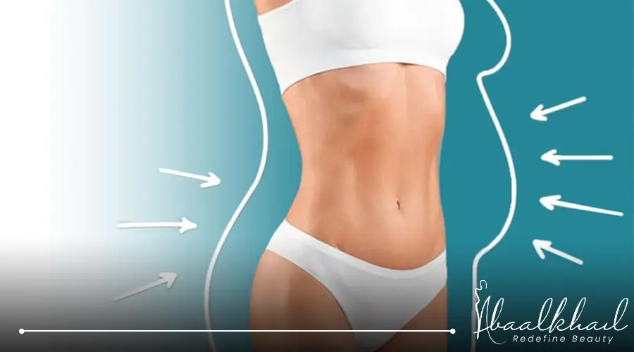 شفط الدهون بالفيزر قبل وبعد