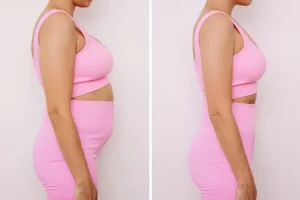 صور تجارب شفط الدهون بالفيزر قبل وبعد