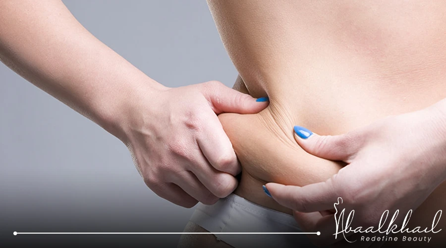 ندمت على عملية شد البطن​